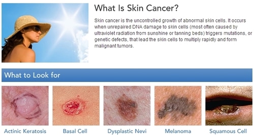 skin cancer what to look for examples. cancer cells